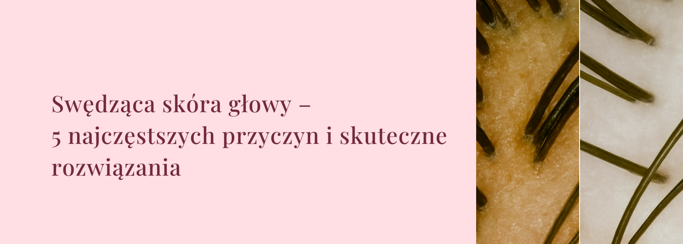 Swędząca skóra głowy – 5 najczęstszych przyczyn i rozwiązania